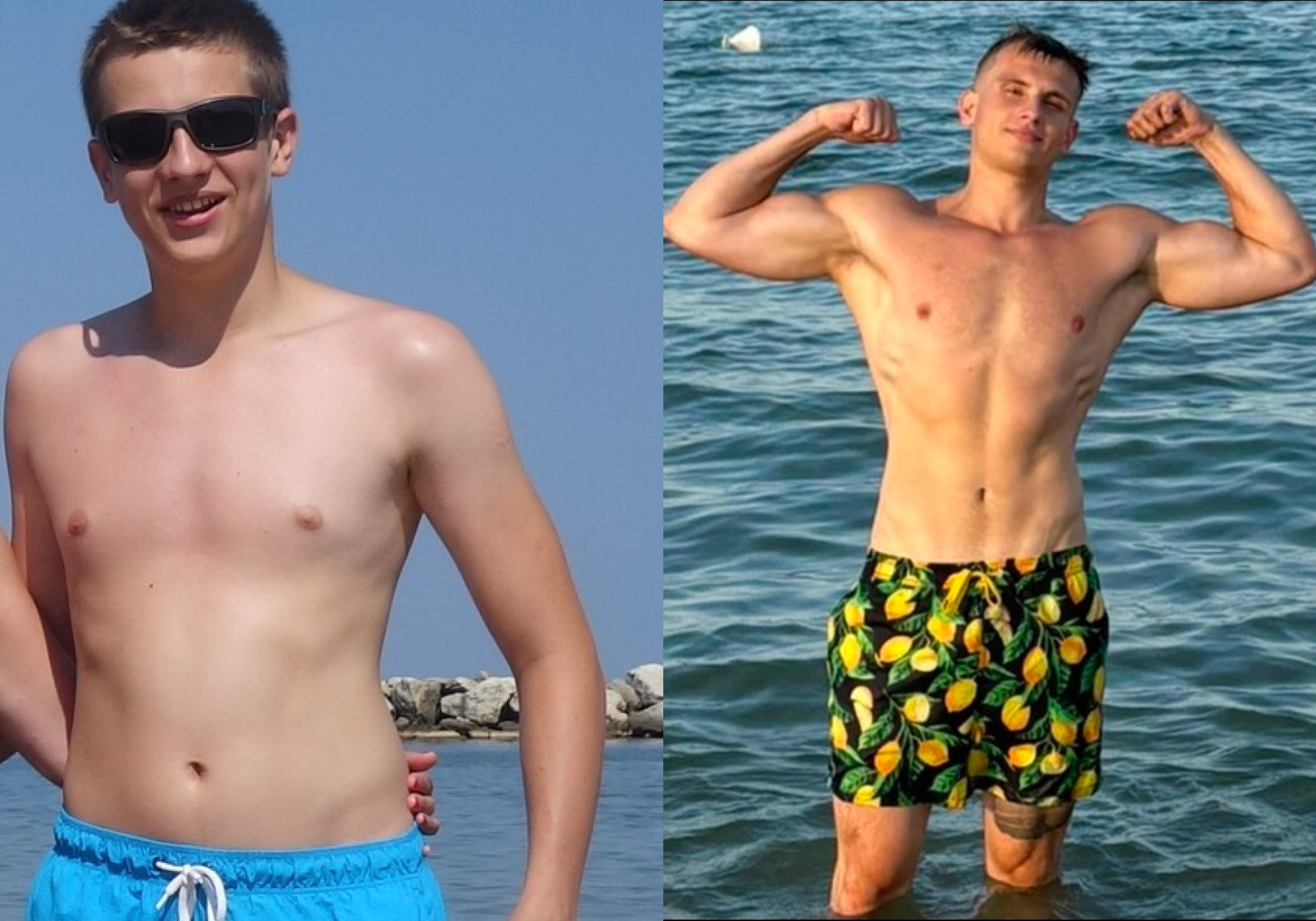 vojo befre after vojo befre after